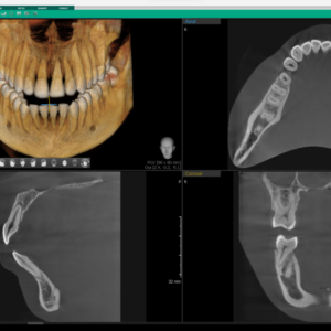 Vatech A9 2D/3D/Ceph