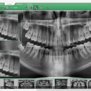 Vatech Pax-i Insight 2.5D Ceph